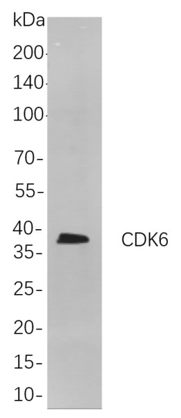 Recombinant CDK6 Monoclonal Antibody (AN301060L)