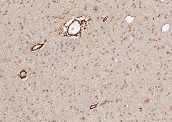 Recombinant Neuroligin 1/NLGN1 Monoclonal Antibody (AN300236P)