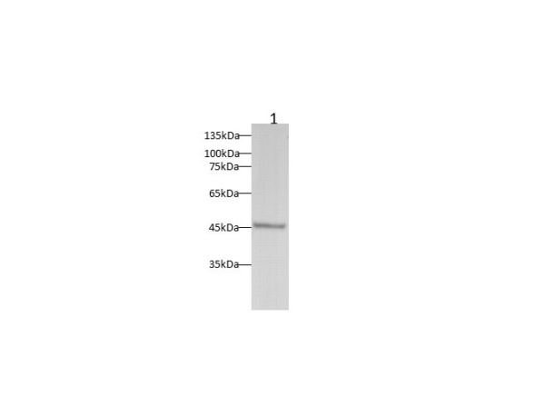 PAI1 Polyclonal Antibody (D-AB-10382L)