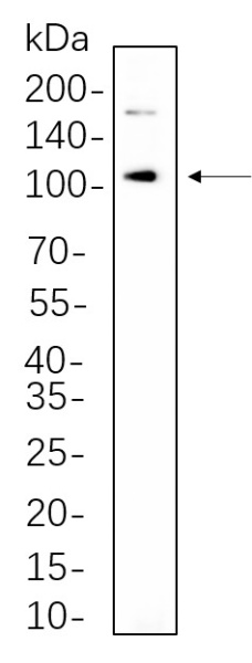 Recombinant IRE1α Monoclonal Antibody (AN301344L)