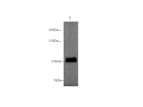 ST14 Polyclonal Antibody (D-AB-10117L)