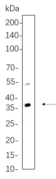 Recombinant ATG3 Monoclonal Antibody (AN300723L)