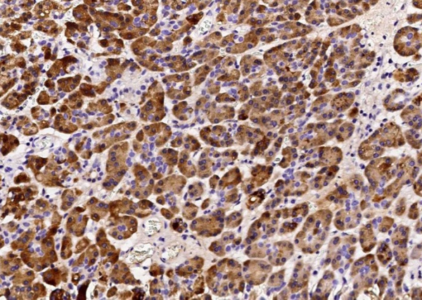 Recombinant REG1B Monoclonal Antibody (AN300405P)