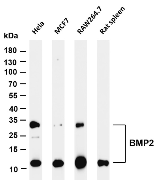 Recombinant BMP2 Monoclonal Antibody (AN302121L)