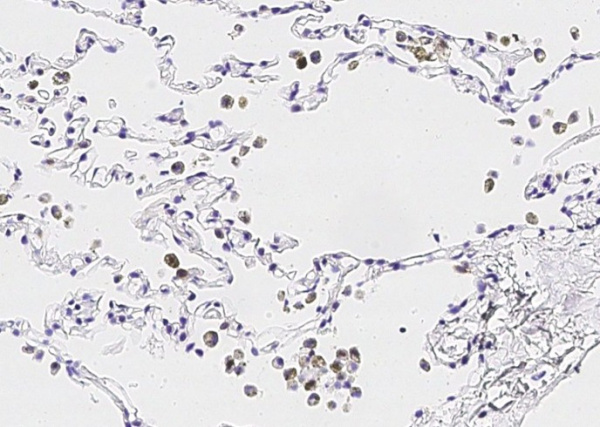 Recombinant IL36G/IL1F9 Monoclonal Antibody (AN300302P)