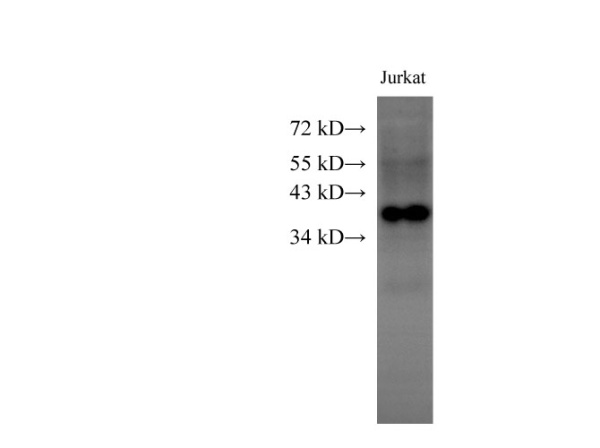 HMG20B Polyclonal Antibody (E-AB-40258)