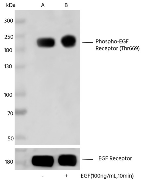 Recombinant Phospho-EGF Receptor (Thr669) Monoclonal Antibody (AN300011L)