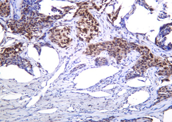 Recombinant Histone H4 (Acetyl Lys8) Monoclonal Antibody (AN301277L)