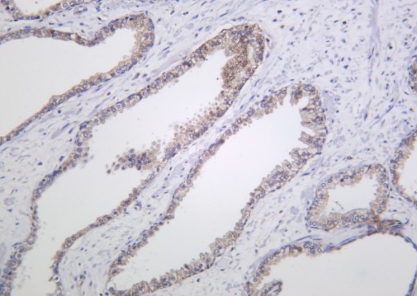 Recombinant Raf-B Monoclonal Antibody (AN301257L)